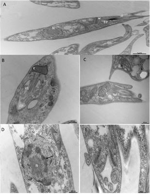 Polymeric nanoparticles containing kojic acid induce structural alterations and apoptosis-like death in Leishmania (Leishmania) amazonensis